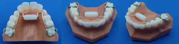 Habit device for thumbing sucking installed on teeth models 