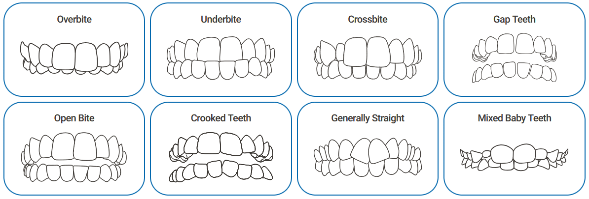 Animated chart of eight different types of bites, showing teeth alignment variations.